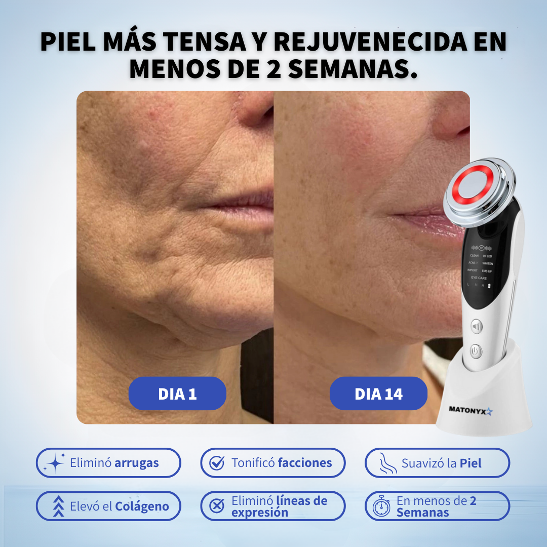Masajeador Facial Antiarrugas