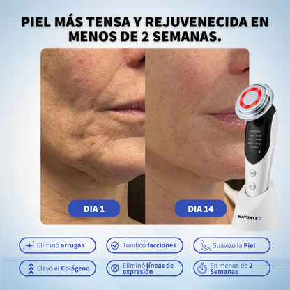 Masajeador Facial Antiarrugas