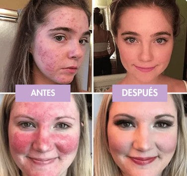 Base de Maquillaje MOISTURE CUSHION™