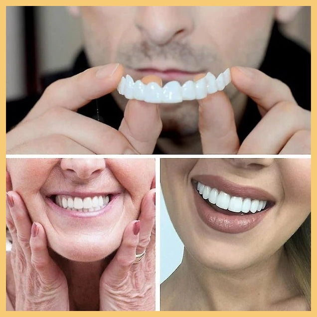 LENTE CERÁMICA DENTAL - Lumineo™
