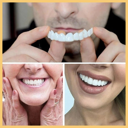 LENTE CERÁMICA DENTAL - Lumineo™